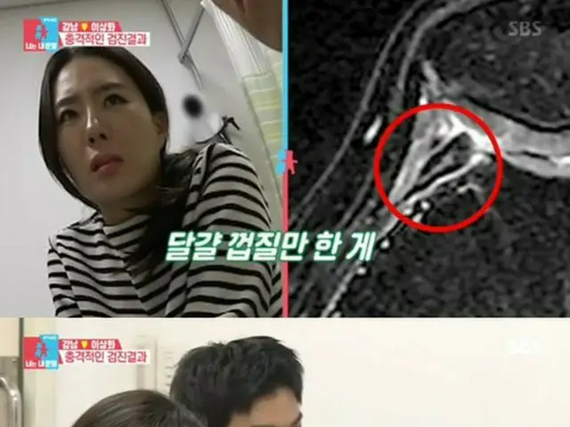 KangNam worried about his wife Lee Sang-ha . ● Lee Sang-ha's knee has a largerinner synovial fold th