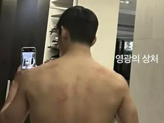 "BTS" V, surprised by his bulked up and wider back... "Injury to his reputation"