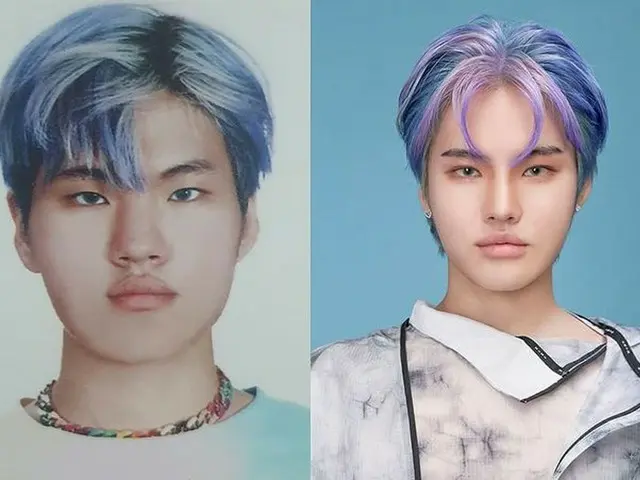 Rapper Takuwa, photos before and after plastic surgery are released.