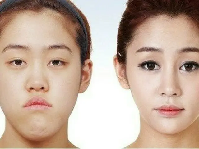 Ho Ye-eun, who succeeded in the cosmetic surgery program “Let Beauty”, which is 