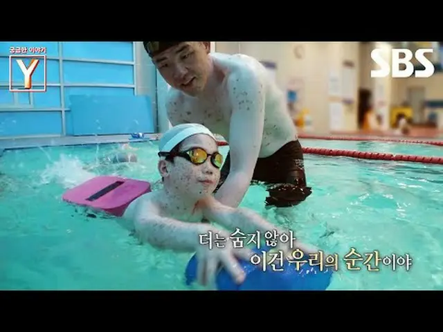 #skin #bodybuilding #SBSEducation #InterestingStoryY #YStory #InterestingStoryYt