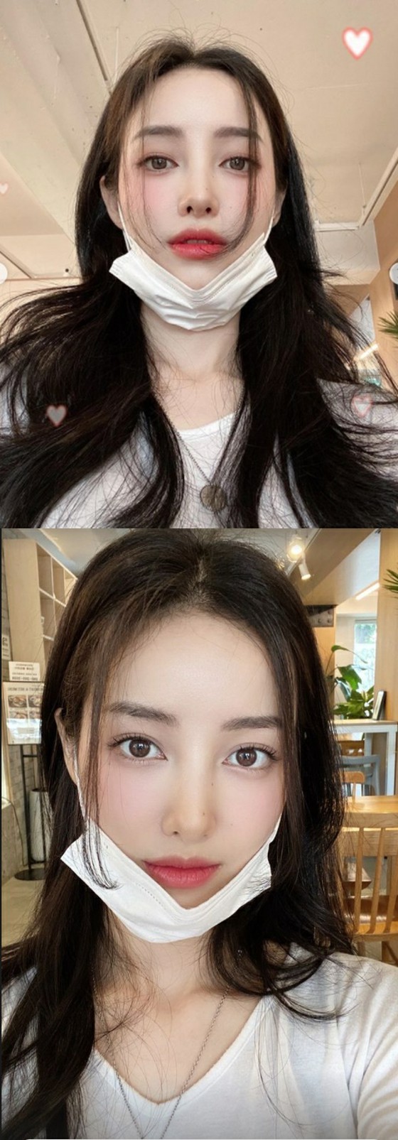 Beauty YouTuber YU CAT NIP reveals recent status after "chest and face surgery"