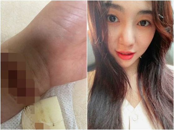 Kwon Mina (former AOA) tries to commit suicide again...? Mentions Jimin again "Will she come back after the interruption?"
