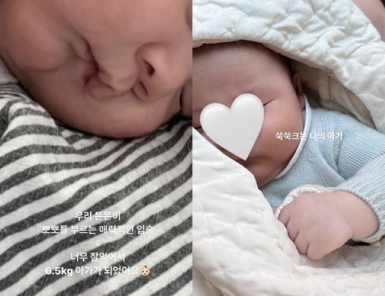 G-DRAGON (BIGBANG)'s older sister Kwon Dami reports on the growth of her eldest son "Weight to 6.5 kg"