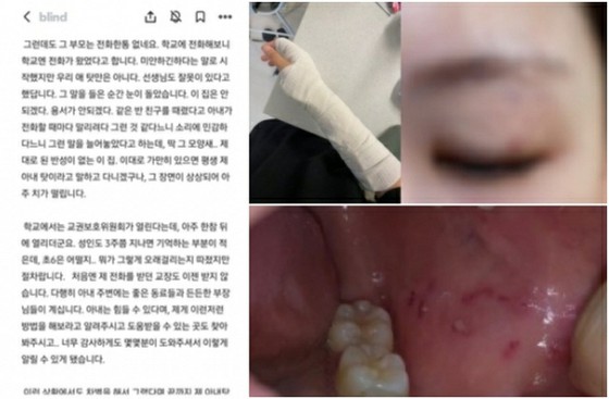 6th grade student 'assaults' female teacher... Teacher 'lawsuit' against parents = Korea