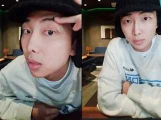 "BTS" RM receives 5 stitches in his eye, but says "I'm fine" on LIVE STREAM