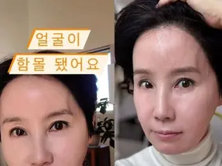 Singer Park Hae-kyung woke up with a sunken face...What happened? …“I’m scared for no reason”