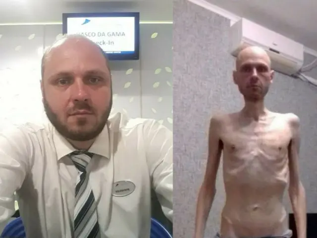 身長190センチで57キロ…釈放されたウクライナ人捕虜の衝撃的な姿