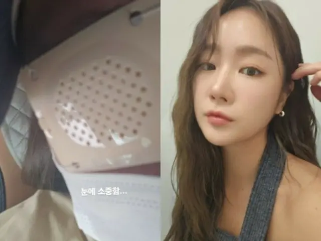 SOYOU (former SISTAR), sudden eye injury "Corneal scratch... I can't see, I was so surprised"