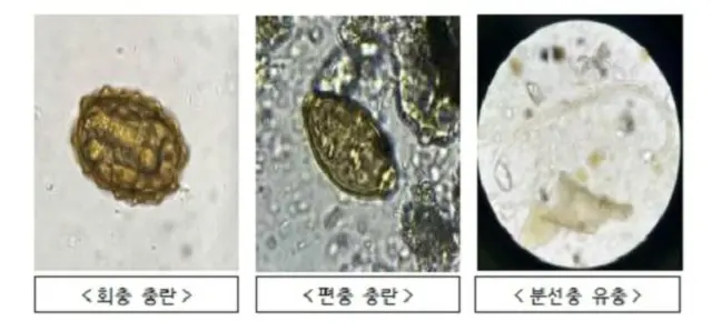 北朝鮮の “汚物風船”から「寄生虫」が発見＝韓国
