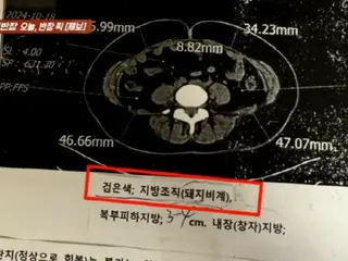 "If you feel sick, don't come" - Doctor calls patient's fatty tissue "pig fat" (South Korea)