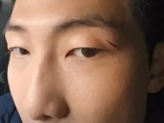"BTS" RM reveals a deep scar on his handsome face...a painful scar above his eye