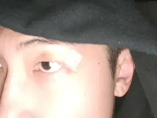 "BTS" RM, is the scar above his eye okay?